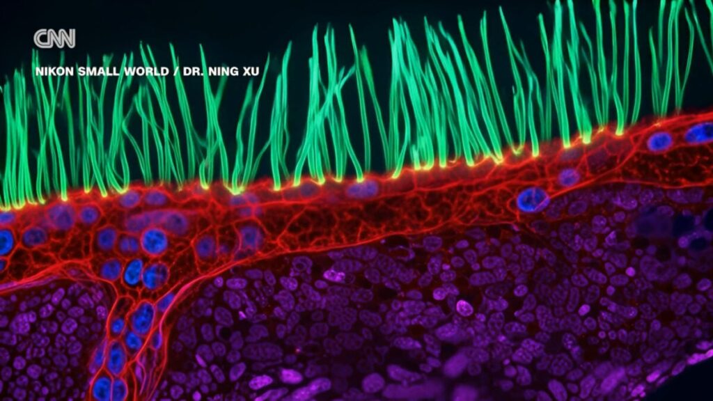Contest-Winning Microscope Video Is Full of AI Confabulations, Scientists Say Contest Winning Microscope Video Is Full of AI Confabulations, Scientists Say