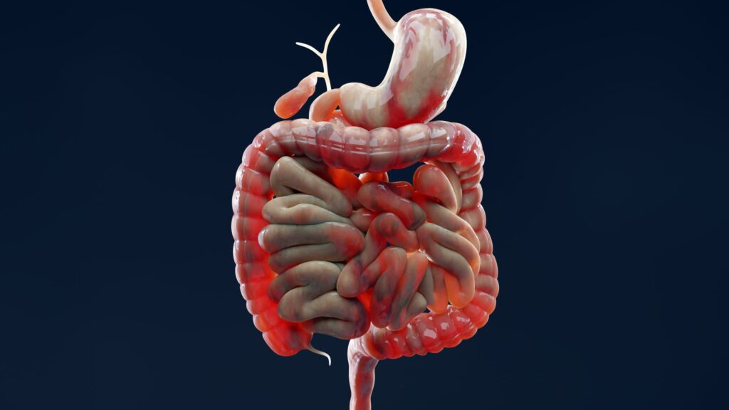 Why Does IBD Keep Flaring Up? Scientists Found a Clue